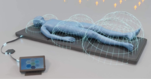 imrs2000 blood circulation